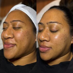 Brighten facial