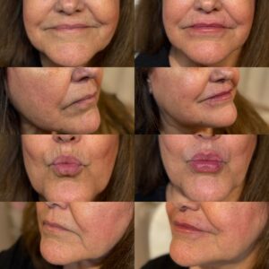 lower triangle filler