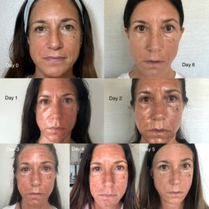 124258 Neogen shredding process