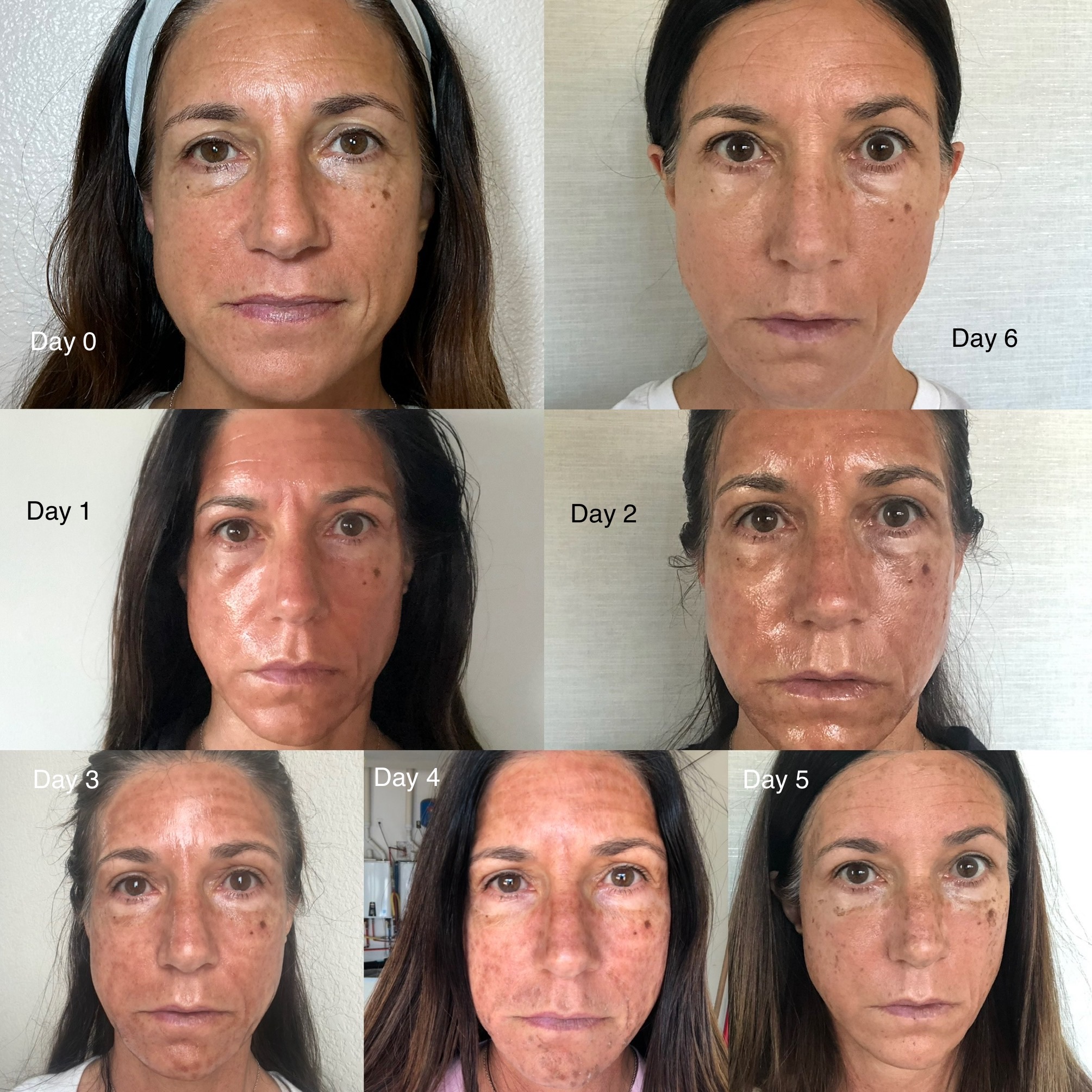 Before and After Image: Neogen shedding process - front